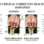 What is Upper Cervical Chiropractic?
