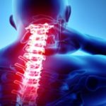 Where Neck Stiffness & Upper Back Pain Come From